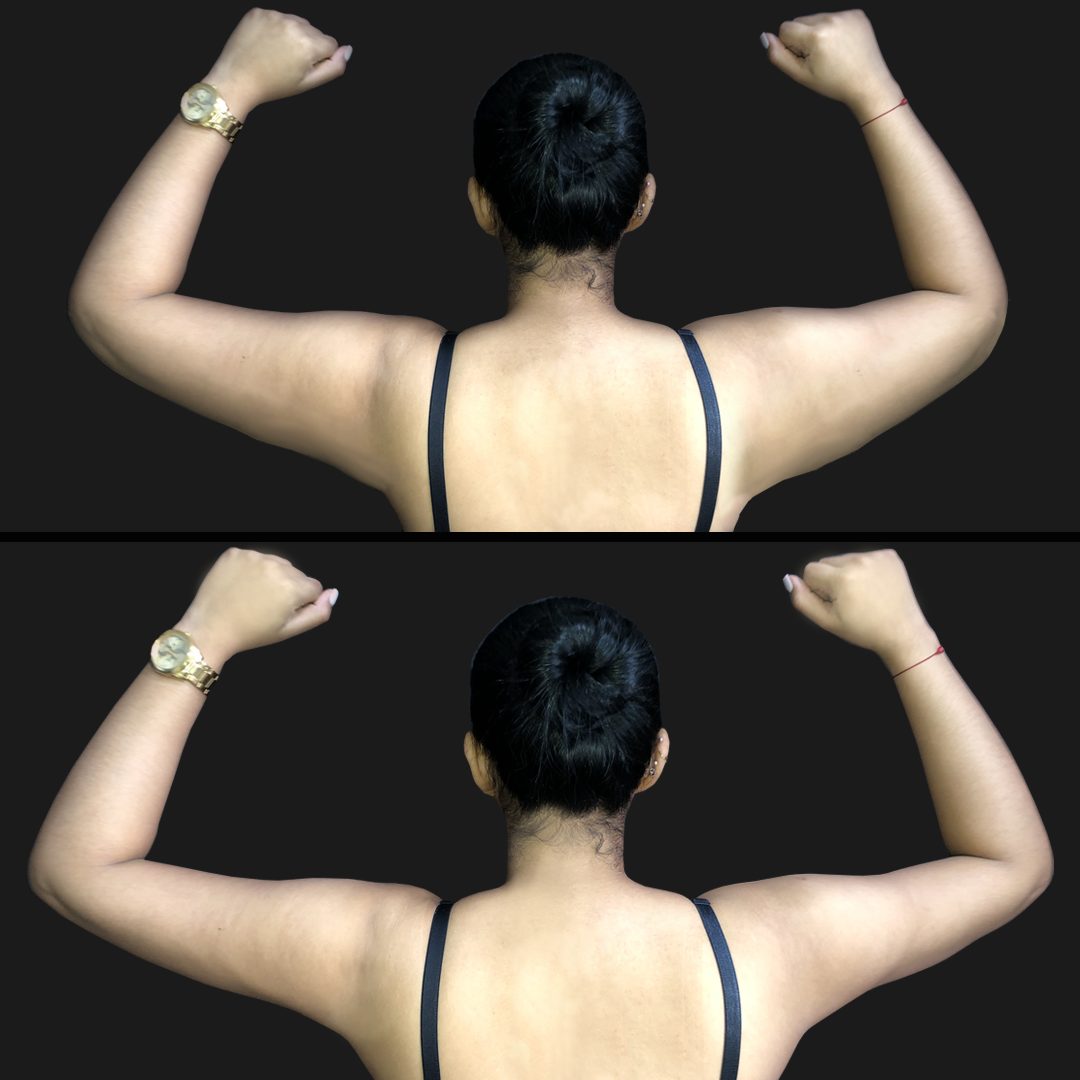 Brazos — Real·C Clínica, Dr. Marcelo Moncayo, Guayaquil