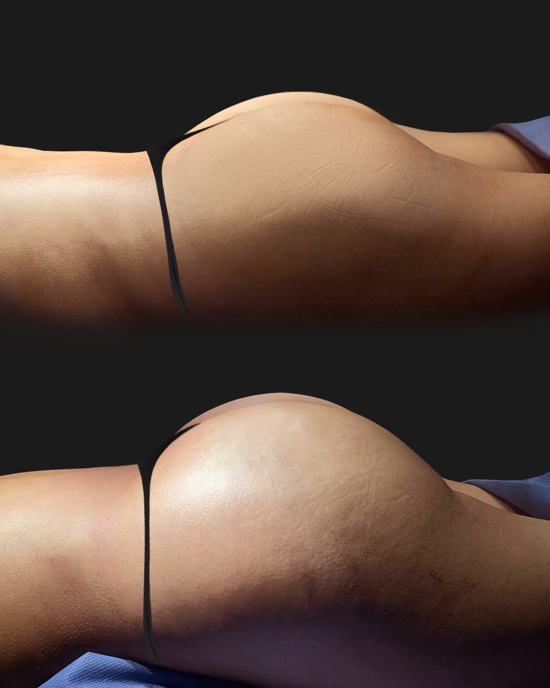 Glúteos — Real·C Clínica, Dr. Marcelo Moncayo, Guayaquil