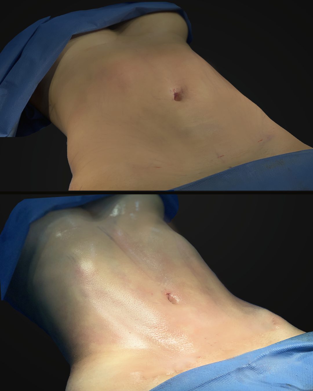 Lipo HD — Real·C Clínica, Dr. Marcelo Moncayo, Guayaquil