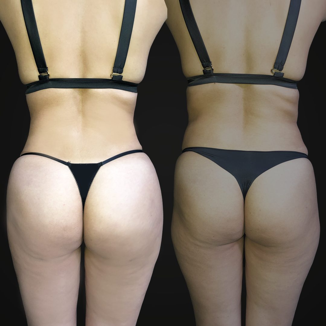 Piernas — Real·C Clínica, Dr. Marcelo Moncayo, Guayaquil