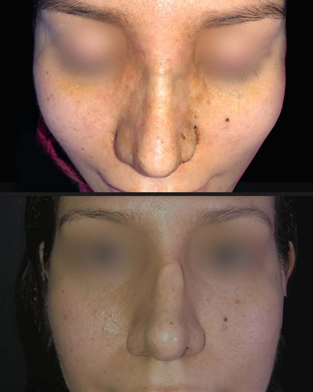 Rino reconstructiva — Real·C Clínica, Dr. Marcelo Moncayo, Guayaquil