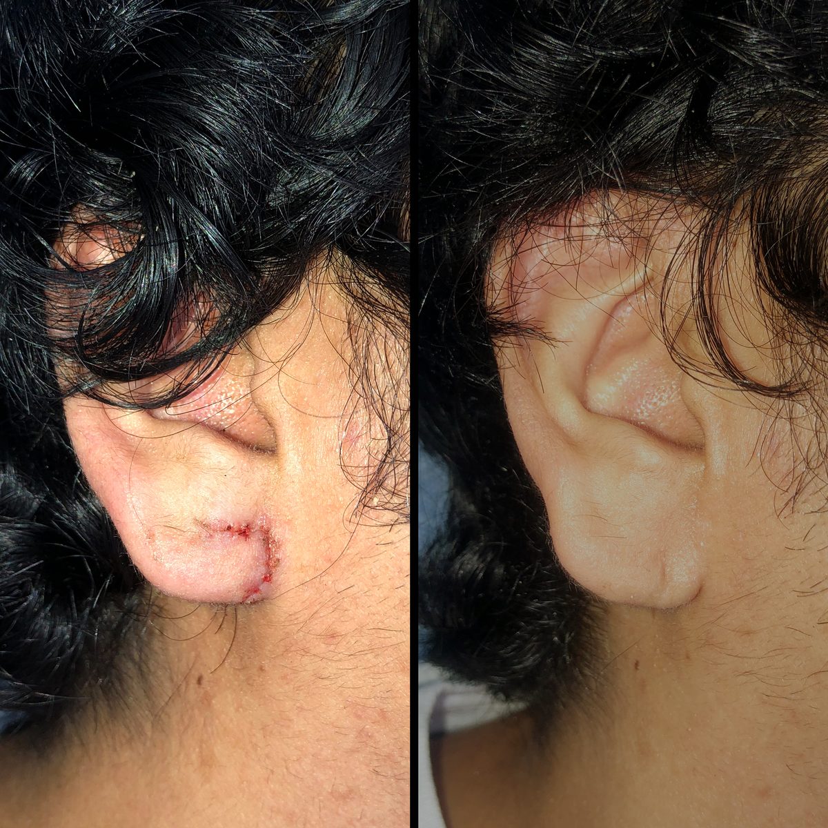 Lóbulos — Real·C Clínica, Dr. Marcelo Moncayo, Guayaquil