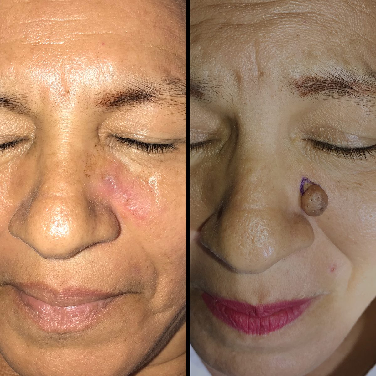 Lunares — Real·C Clínica, Dr. Marcelo Moncayo, Guayaquil