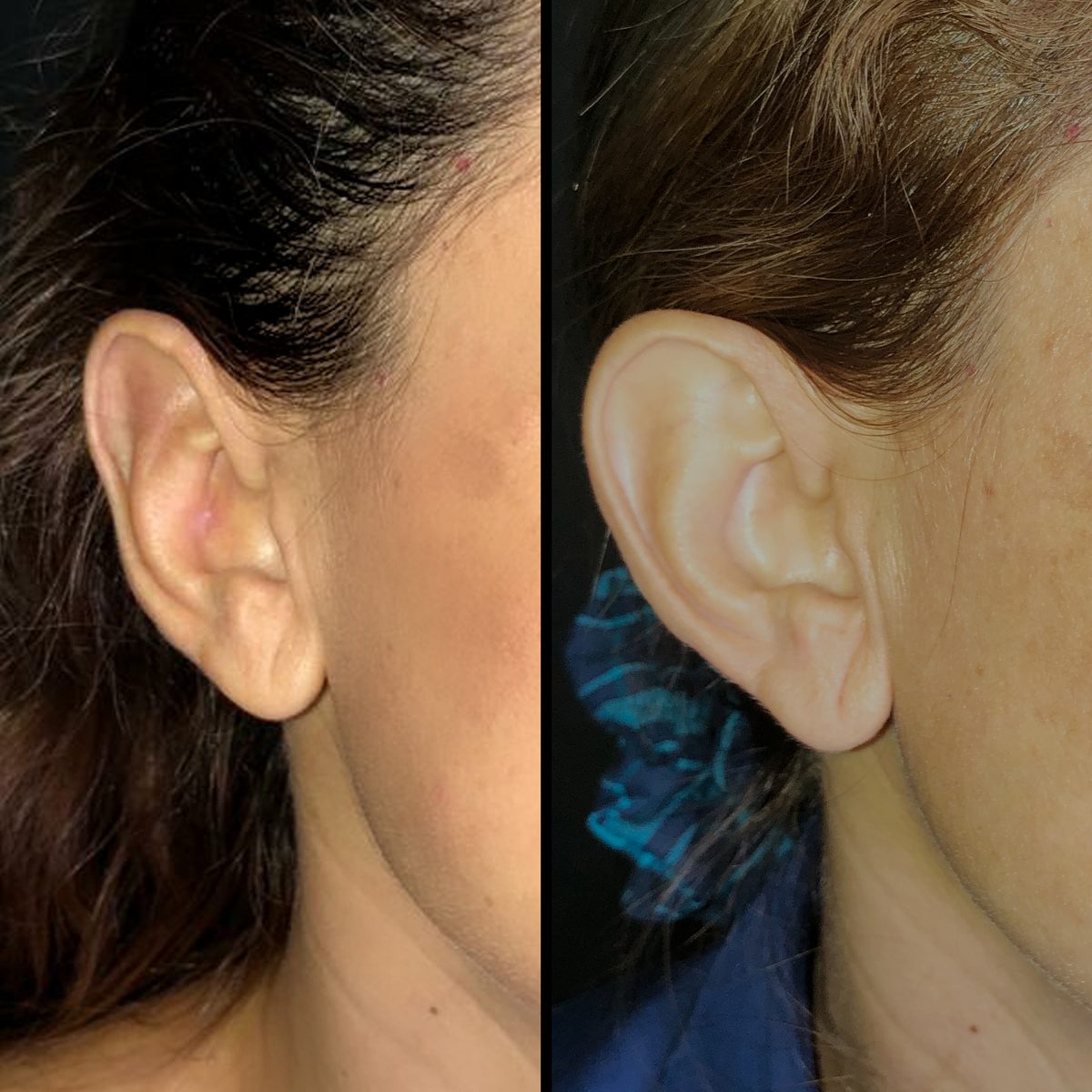 Orejas prominentes — Real·C Clínica, Dr. Marcelo Moncayo, Guayaquil