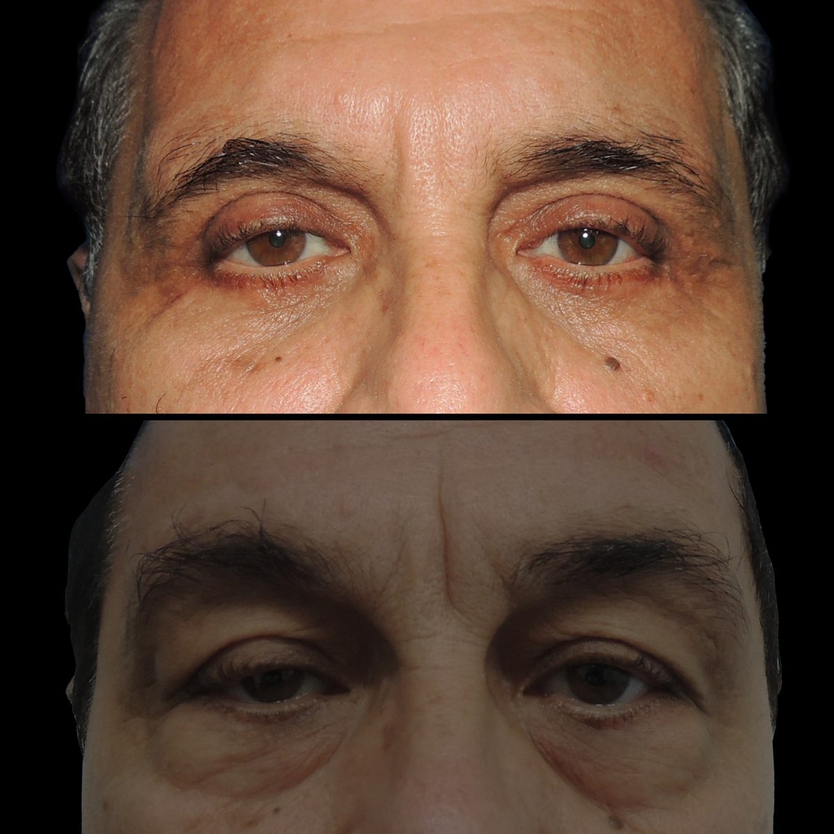 Párpados — Real·C Clínica, Dr. Marcelo Moncayo, Guayaquil