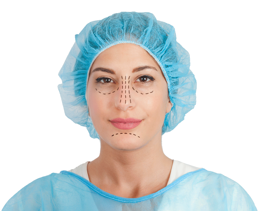 Rinoplastia — Real·C Clínica