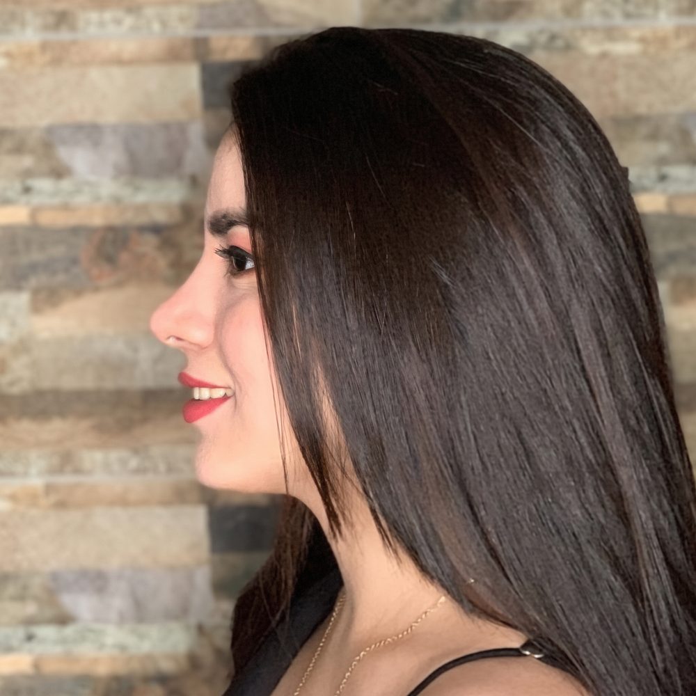 Mónica A., Rinoplastia — paciente feliz de Real·C Clínica